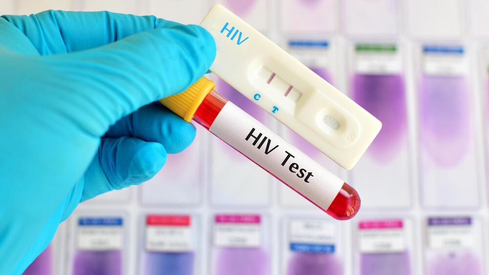 HIV Virus Medical Concept